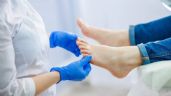 Remedios caseros para eliminar los hongos de las uñas de los pies