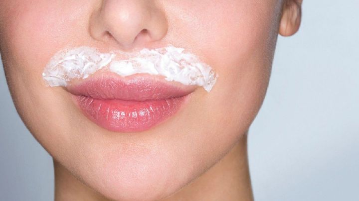 Melasma o manchas en el bigote: Consejos efectivos para combatir esta afección de la piel